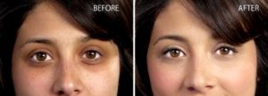 I 5 errori più comuni nel makeup che penalizzano e invecchiano_Elisa Bonandini Image Consulting